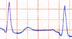File:Cardio.jpg